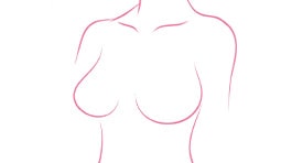 Breast-cancer