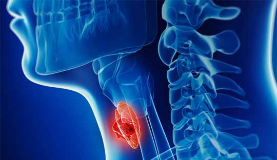 Head-and-neck-cancer