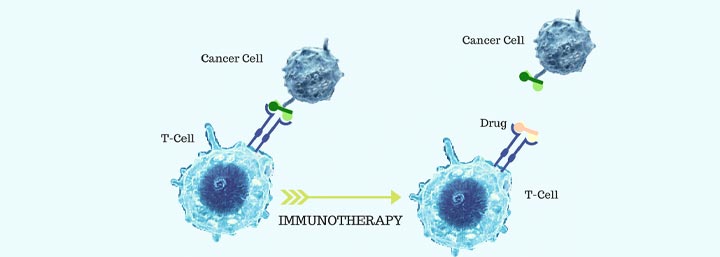 Immunotherapy