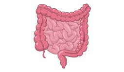 Intestinal-cancer